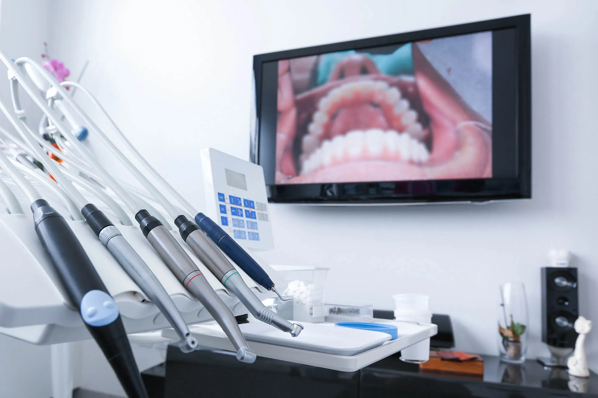 preparing for laser dentistry walnut creek ca