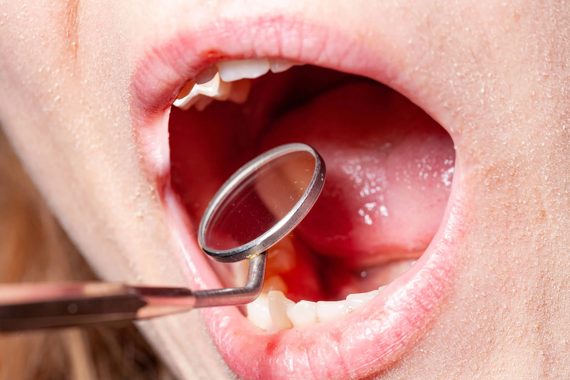 walnut creek dentist checks tooth