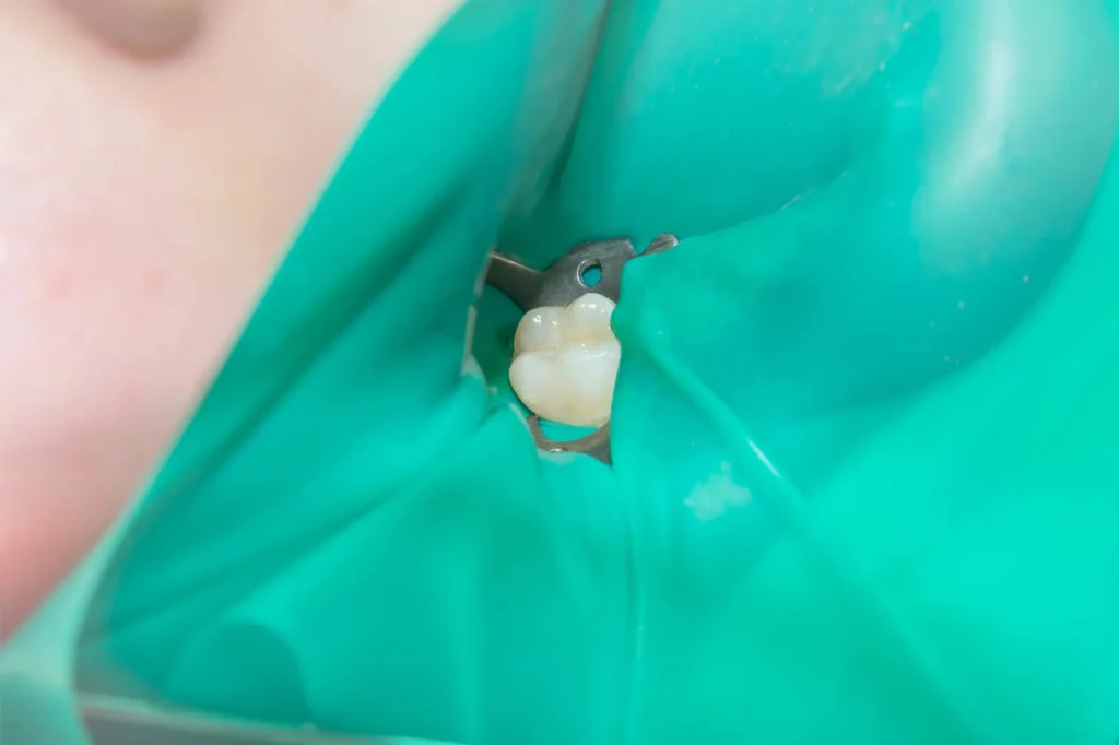 walnut creek dentist examines tooth