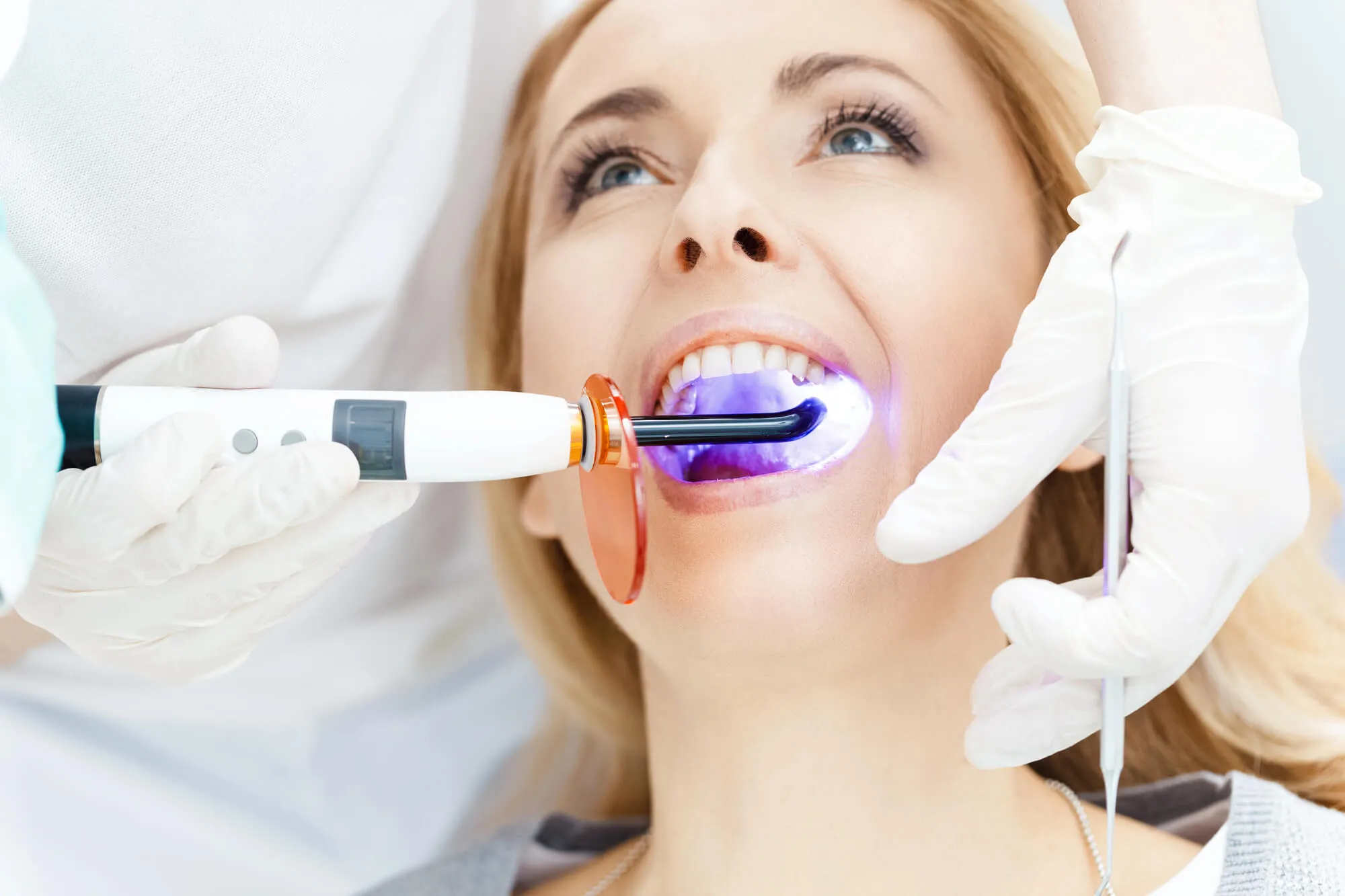 affordable teeth whitening walnut creek