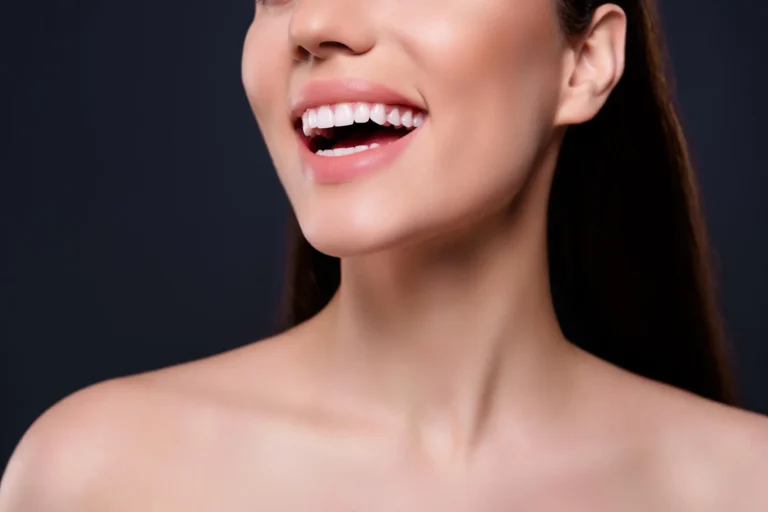 newly placed veneers walnut creek