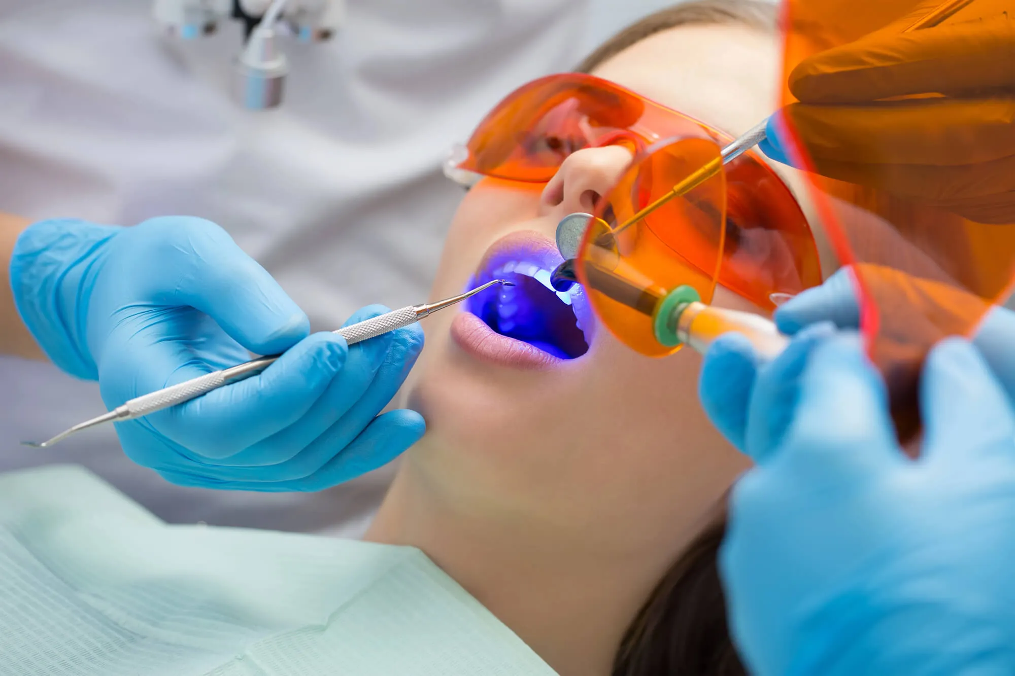 patient chooses teeth whitening over veneers walnut creek