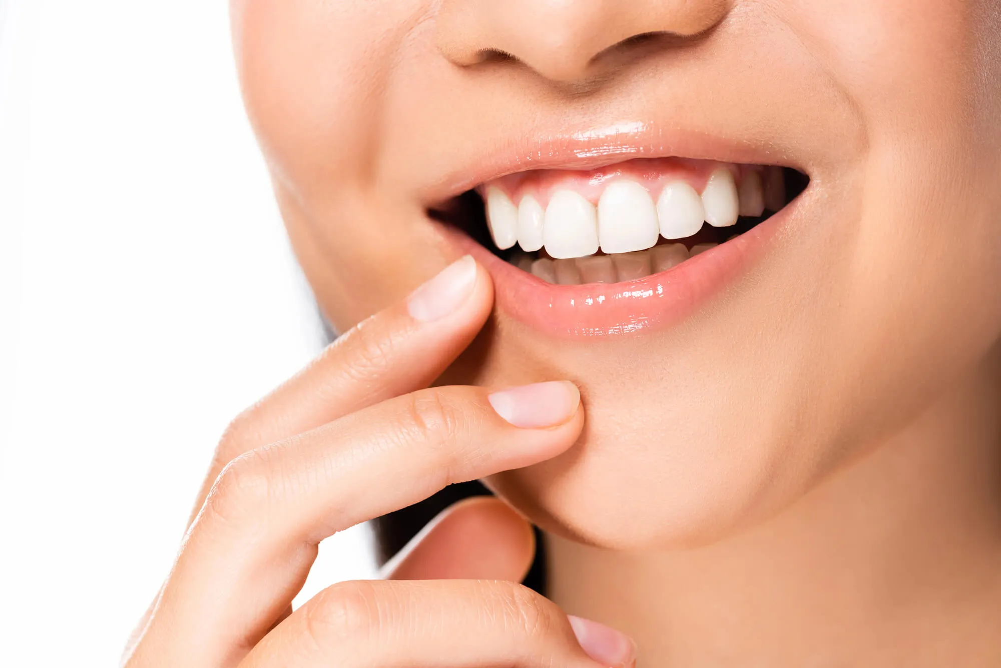 veneers walnut creek